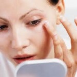 dark circles 1