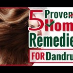 #dandruffremedies
