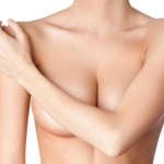 causes of stretch marks on breast