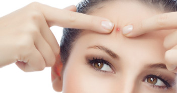 Home Remedies for Pimples  Acne – Acne Scars- All about It