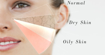 Skin types
