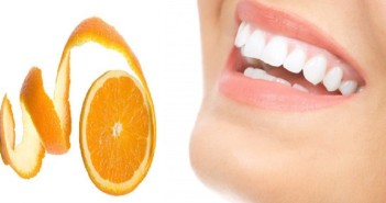 teeth5