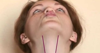 Get Rid Of Double Chin In Just 10 Minutes4