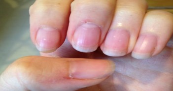 Home Remedies And Tips For Healthy And Beautiful Nails7