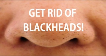 Say Goodbye To Blackhead With This Simple Trick1