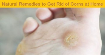home remedies for corns