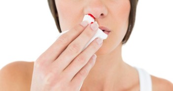 nose bleed