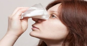 nose bleed1