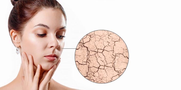 Tips To Prevent Dry Skin 